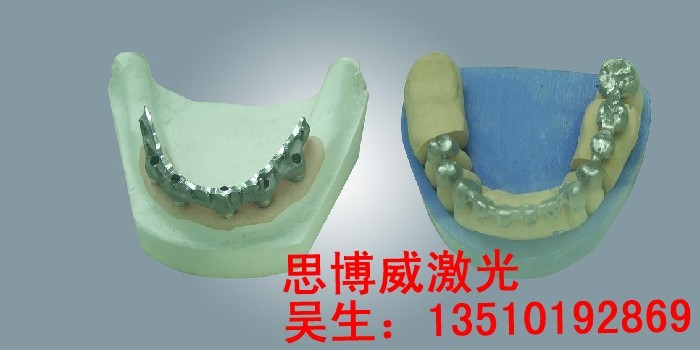 供应假牙义齿激光点焊机