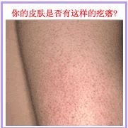 供应美白精华液