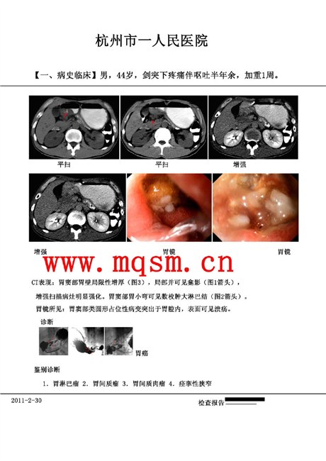 供应磨砂激光打印胶片
