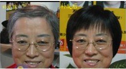 供应织发补发|专业织发补发机构|郑州织发补发医院【富发科技】
