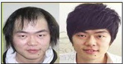 沈阳昂首补发织发+沈阳补发哪家便宜+辽宁补发哪家便宜+铁西补发哪家便宜