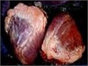 供应冷冻牛心牛肥肉牛脖子肉A级进口巴西