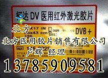 供应柯达医用胶片