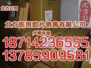 供应爱克发DT1B医用胶片
