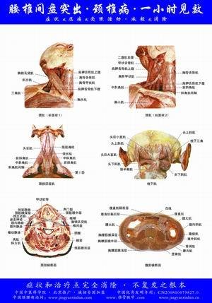 北京腰椎间盘突出医院   北京什么是腰椎间盘突出 颈椎病