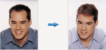 秋季掉发 脱发 补发 厦门 泉州好头发 男女 掉发