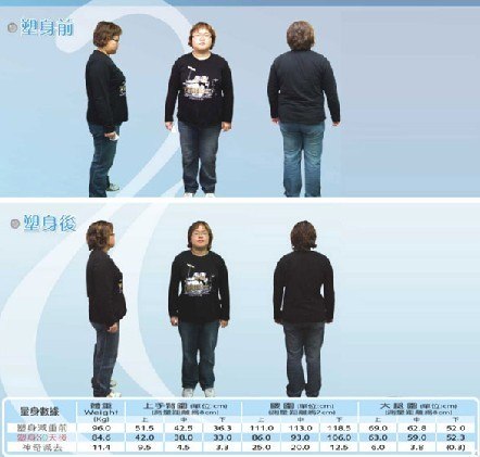 云南局部减肥的办法 云南减肥