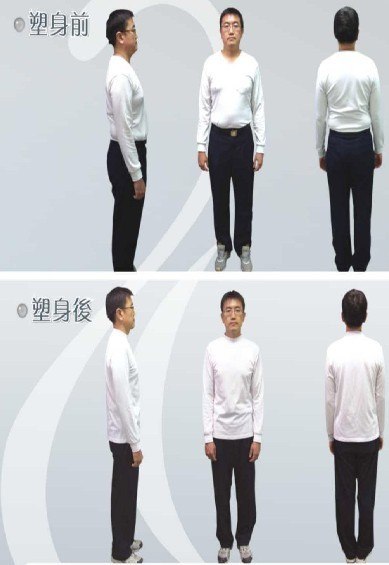 昆明局部肥胖如何减肥-昆明减肥