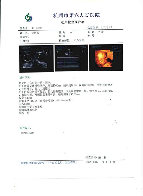 供应激光彩超胶片