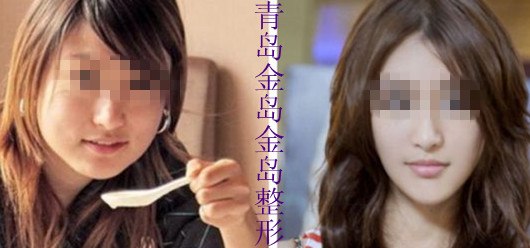 打瘦脸针安全吗  持久吗 【首选金岛徐健】