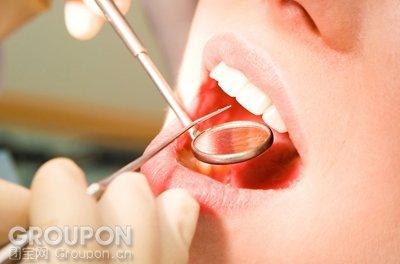 青岛哪里洗牙好？洗牙的注意事项【首选】金岛口腔