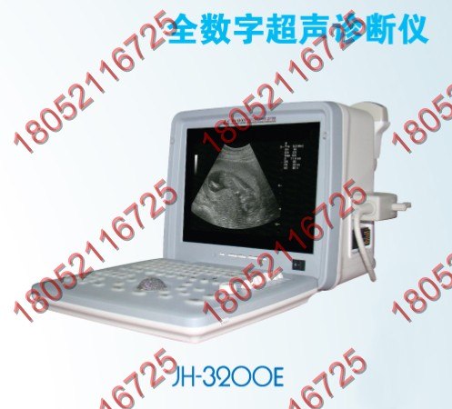 供应台式b超诊断仪