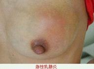 女人40岁做什么/就做催乳吧/赚钱又轻松/还不快加入
