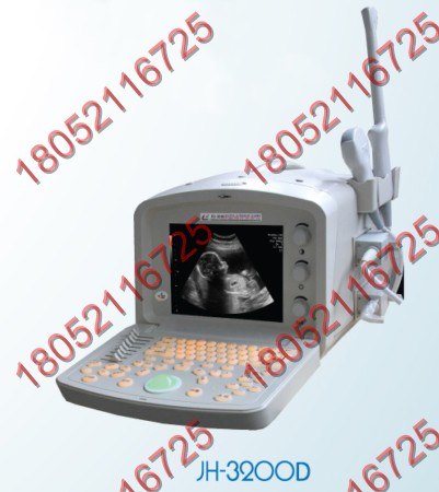 供应B型超声诊断仪（数字化）