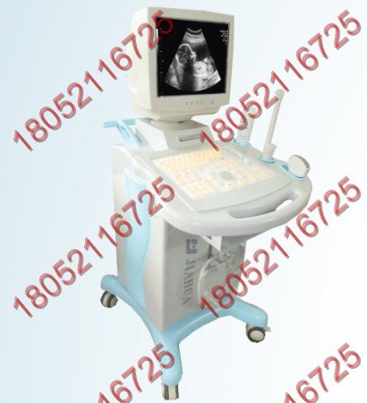 供应推车式b型超声诊断仪