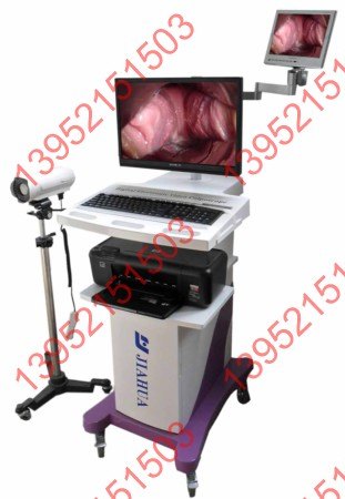 供应光电数码电子阴道镜