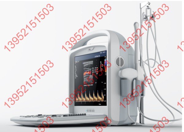 供应便携式B型超声诊断仪