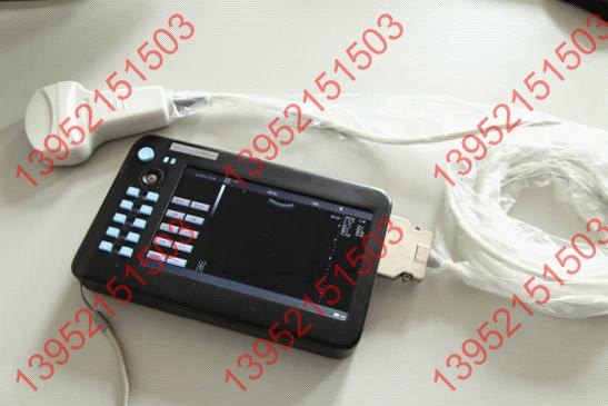 供应全数字通用型黑白B型超声诊断仪