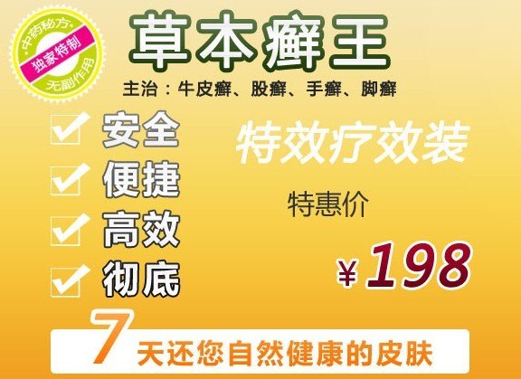 草本癣王 长了牛皮癣怎么办 牛皮癣怎么治