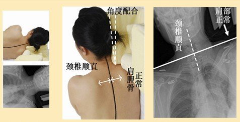 供应供应颈椎变直保健枕