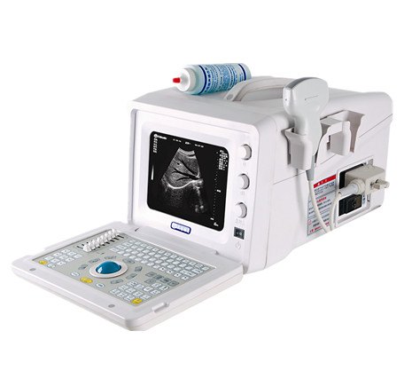 供应DW-3101A彩超机产品报价-B超机