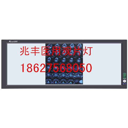 供应广东医用观片灯厂家