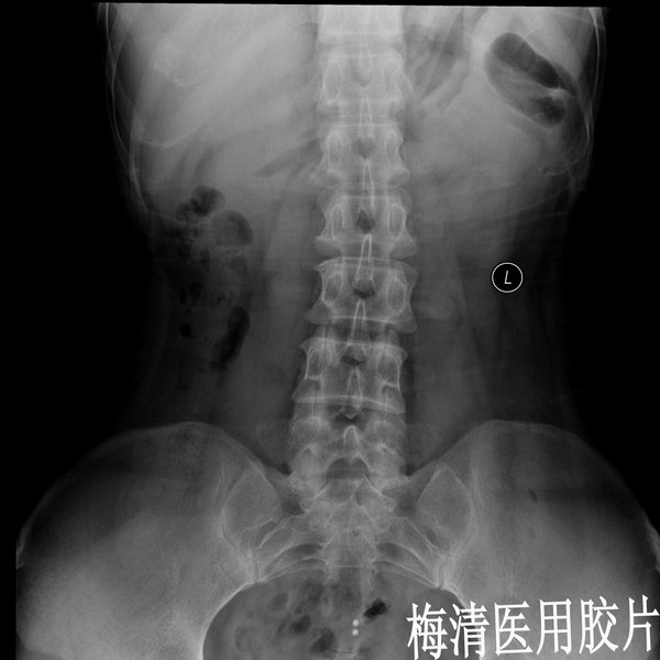 Mei Tsing梅清—多功能医用X光线胶片