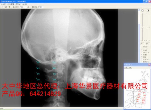 WinCeph 9.0头影测量分析应用软件（单机版）