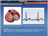 心电图教学与考核软件，心电图教学与考核软件光盘