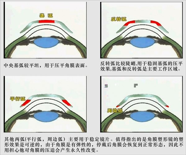 东营近视矫正-1小时提升视力