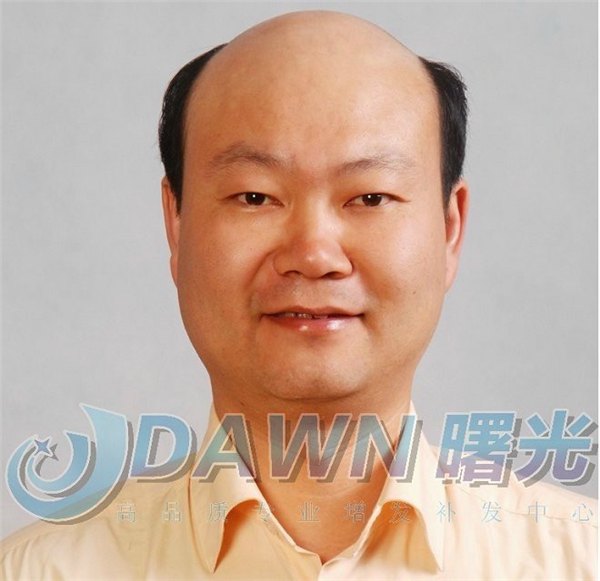 曙光织发补发价格合理的假发，值得您的信赖——优惠
