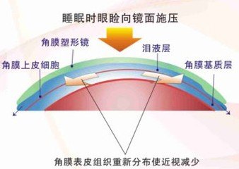 关注孩子视力