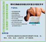 供应术后医用高分子夹板XL-2型