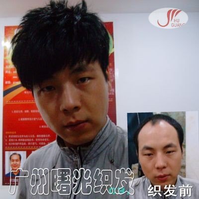 织发补发的优点