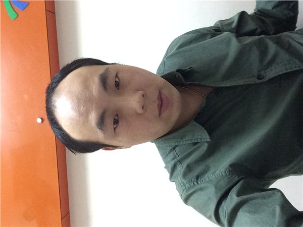 织发补发是产品重要还是技术重要？