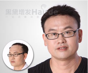黑黛增发效果好吗|上海市黑黛增发