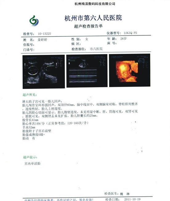 医用干式胶片