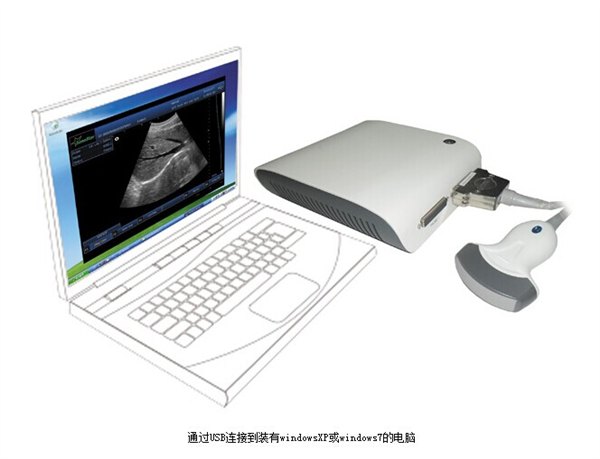 供应Box-10型带三维成像超声盒（B超模块盒）