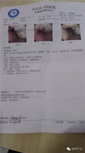 瑞成宇和是骗人食道癌能吃饭干活了