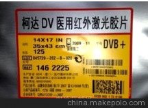 柯达医用胶片,柯达x光胶片,批发,总代理