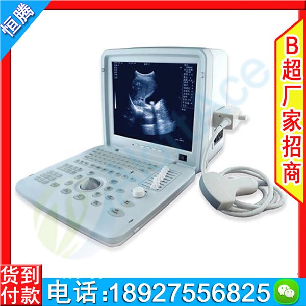 兽用b超机 A2型便携式b超  AloftAce牌彩色b超 猪羊b超机