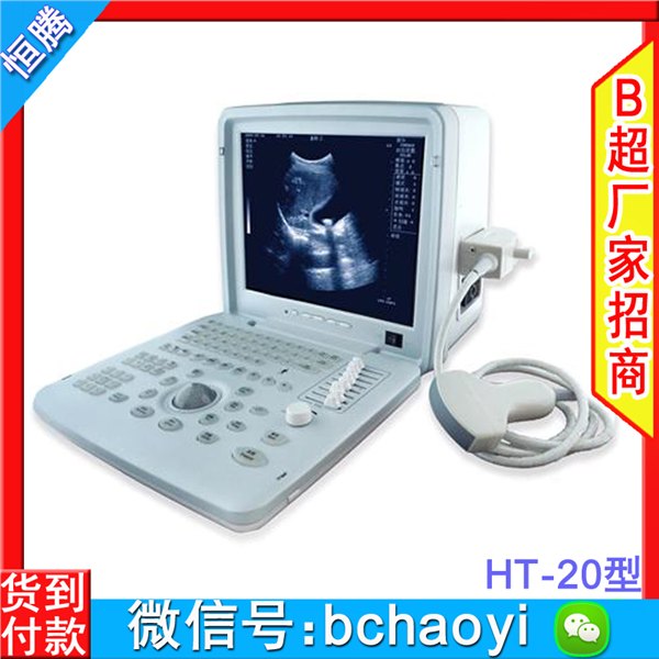 b超机 A2型便携式b超  AloftAce牌彩色b超 b超机