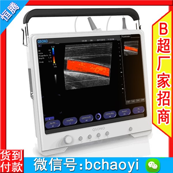 彩超机 A3C型触摸屏彩超仪 AloftAce牌进口彩超 彩超机