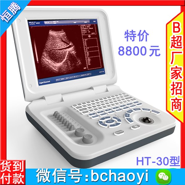 b超机 A5型笔记本b超  AloftAce牌彩色b超仪 b超机