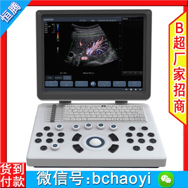 彩超机 A6C型笔记本彩超仪 AloftAce牌进口彩超 彩超机