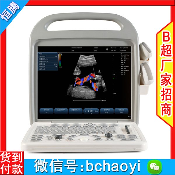 彩超机 A1000型便携式多普勒彩超仪 AloftAce牌彩超 彩超机